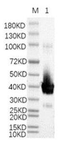 SDS-PAGE (BCL6-158H).jpg